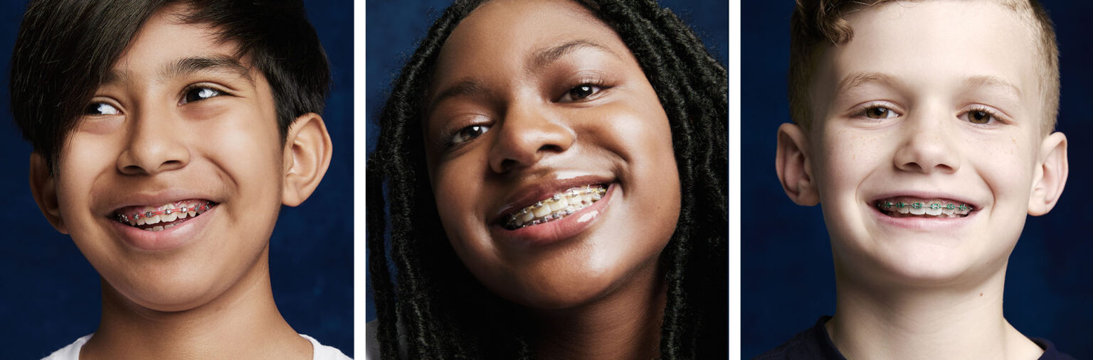 Do Braces Hurt? How to Deal with Braces Pain Smile Doctors