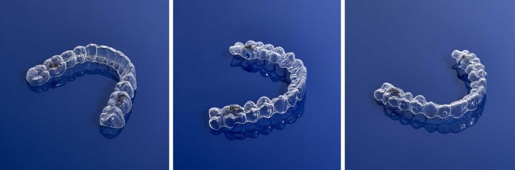 Pros and Cons Invisalign Clear Aligners offered by Smile Doctors aligner trays