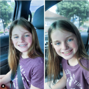 Smile doctors instagram photo of girl