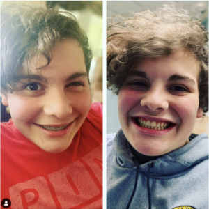 Smile doctors instagram photo of boy
