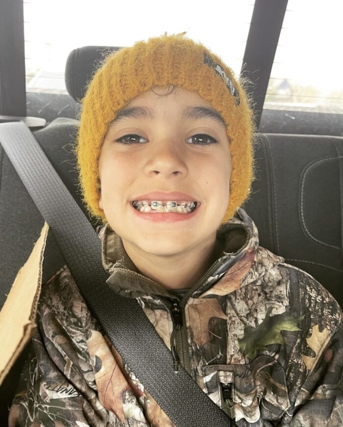 Smile Express® AtHome Invisalign® Aligner Treatment Smile Doctors