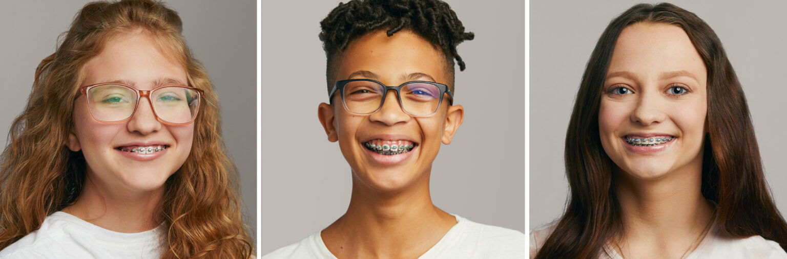 Damon Braces vs Traditional What They Are and How They Work