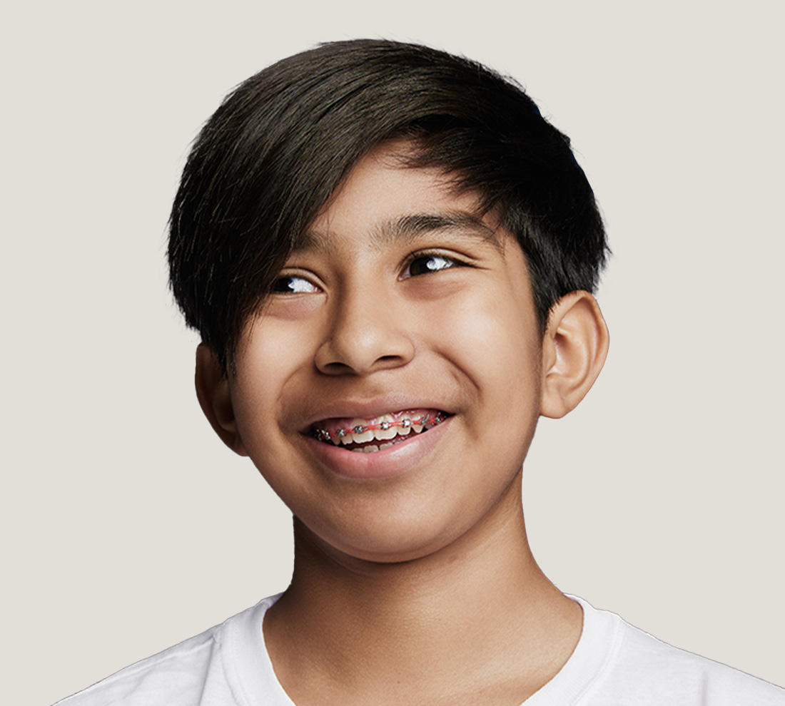 Smile Doctors orthodontic team helping a patient